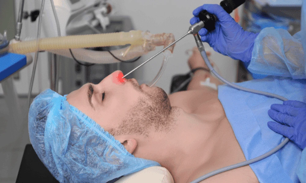 Functional Endoscopic Sinus Surgery: What Recovery and Results Really Look Like